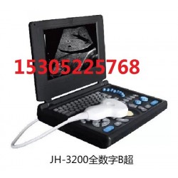便攜式B型超聲診斷儀生產(chǎn)廠(chǎng)家